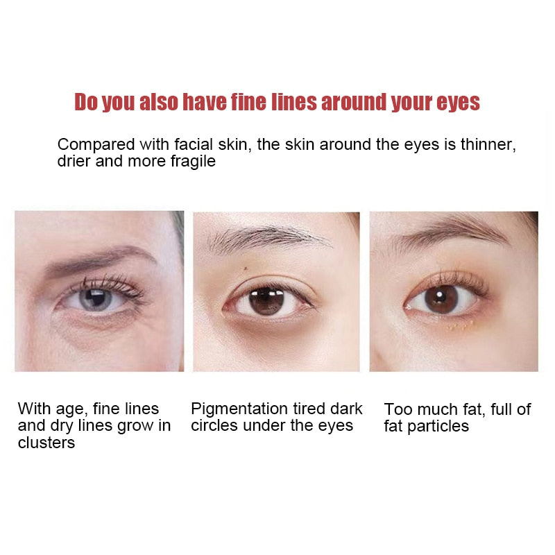 New Anti-Wrinkle Eye Cream